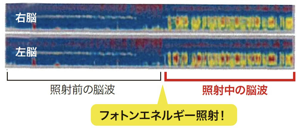 イメージ写真